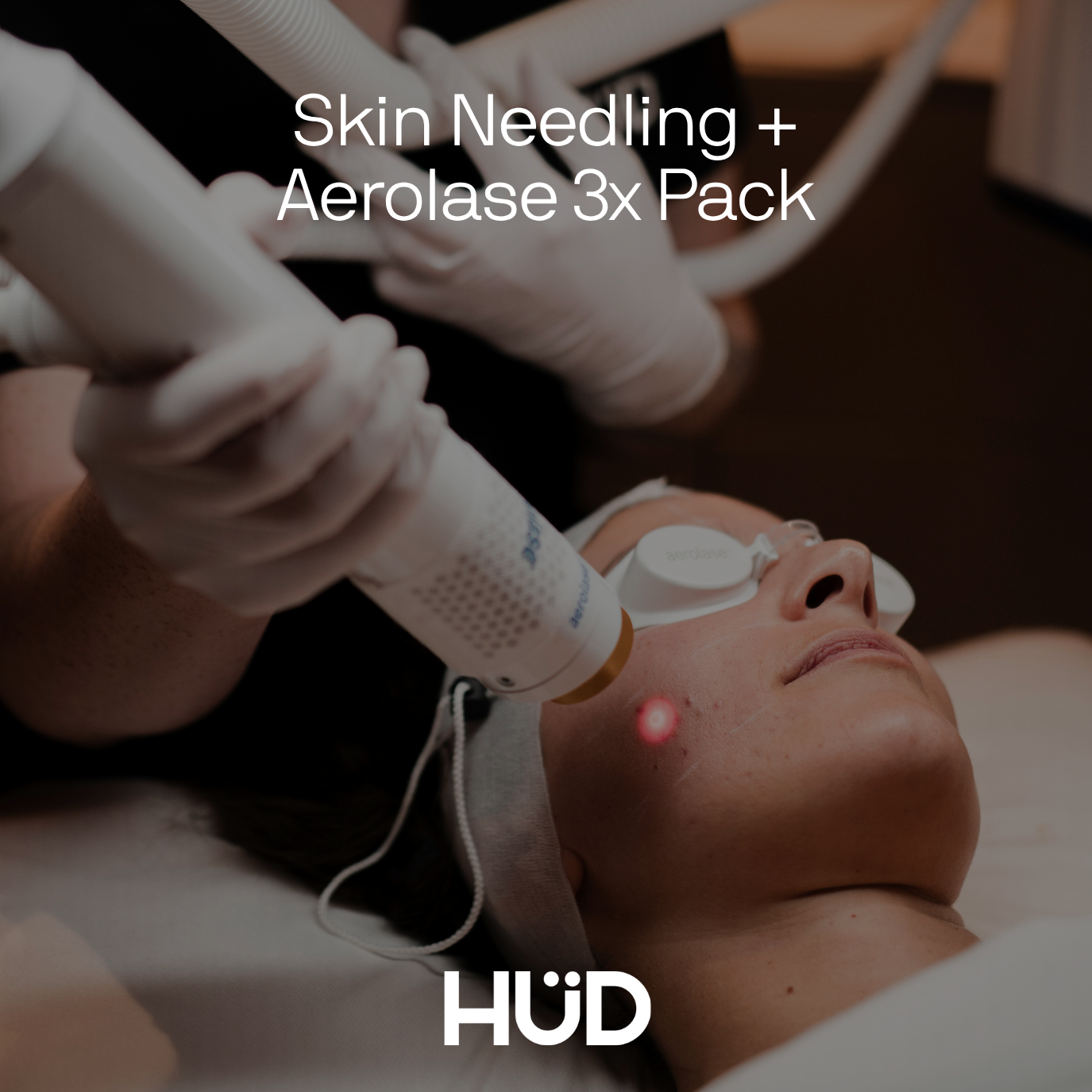 Skin Needling + Aerolase x3 Pack | April Special 🤍 Save $675