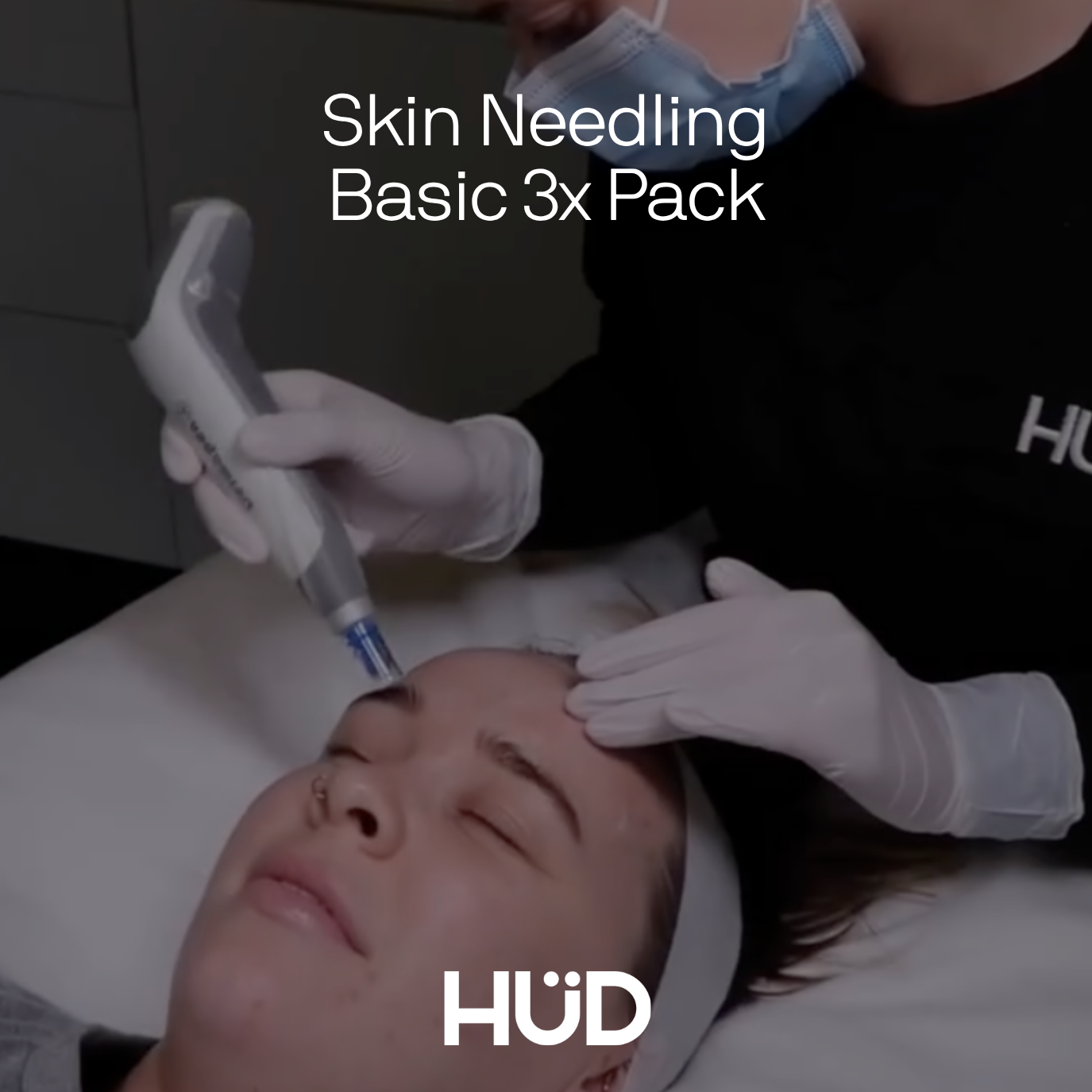 Skin Needling 3x Pack | April Special 🤍 Save $150