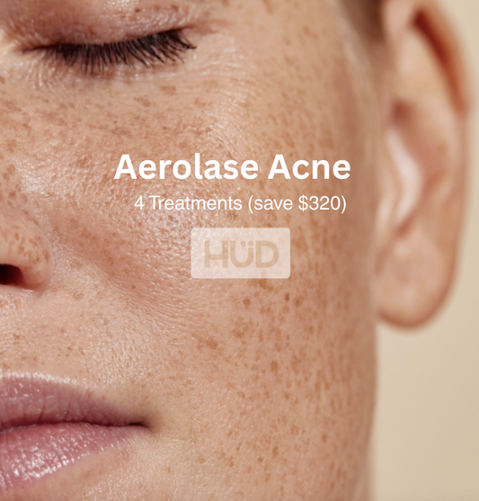 Aerolase Acne Series (4 treatments)  Save $320 🎉 Afterpay + Zip Pay available
